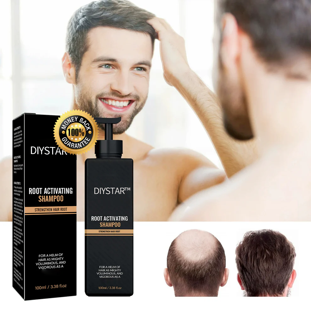 SUMMER Sale Countdown!⏰DIYSTAR™Root Activator Shampoo- Regain a full head of hair in just 6 weeks!