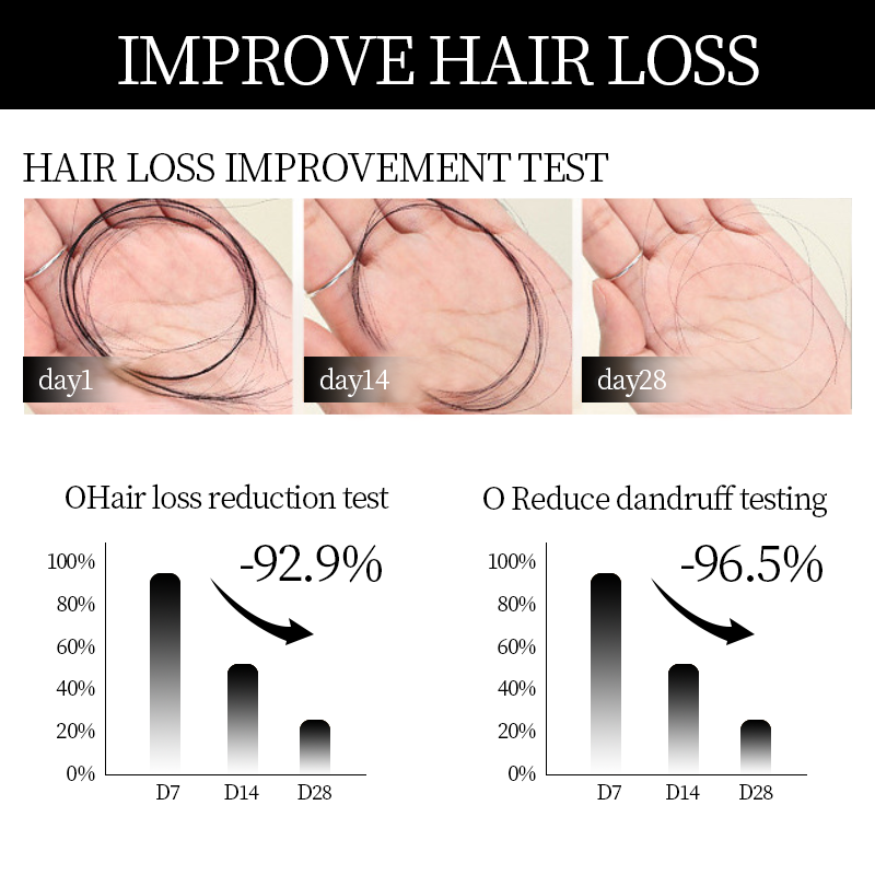 SUMMER Sale Countdown!⏰DIYSTAR™Root Activator Shampoo- Regain a full head of hair in just 6 weeks!