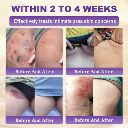 🔥Final 3 Hours 50% OFF - QIAWI® Biotin 10-in-1 Skin Restoration Cream