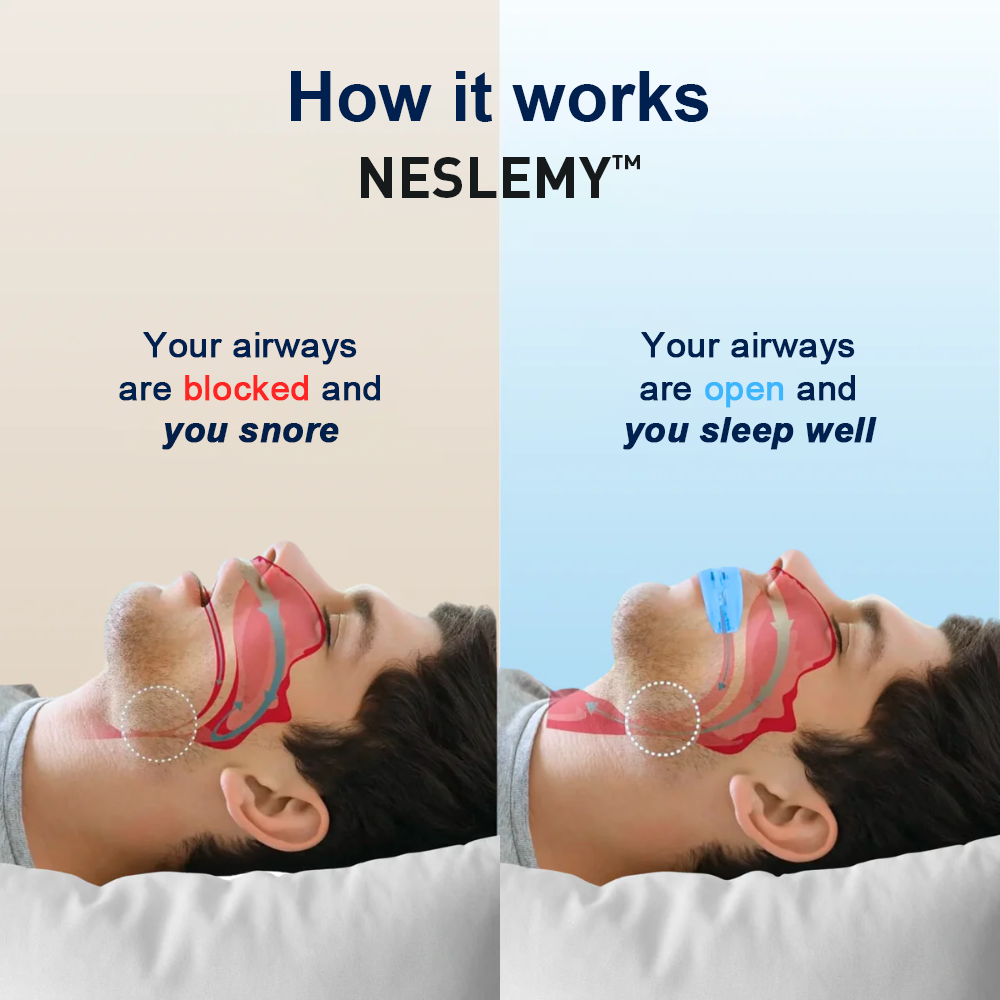 NESLEMY™  Pro fessional intelligent anti-snoring device