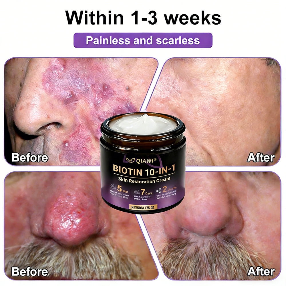 🔥Final 3 Hours 50% OFF - QIAWI® Biotin 10-in-1 Skin Restoration Cream