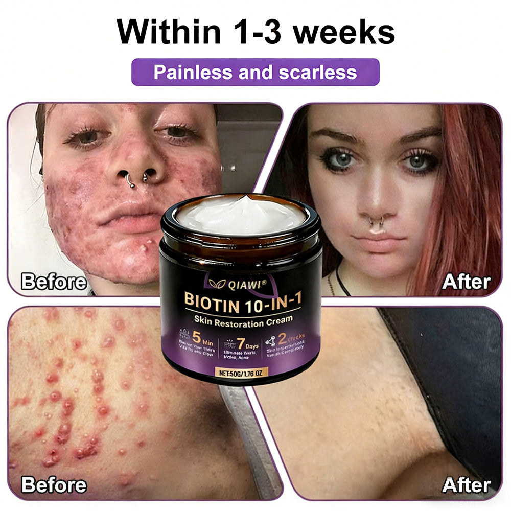 🔥Final 3 Hours 50% OFF - QIAWI® Biotin 10-in-1 Skin Restoration Cream
